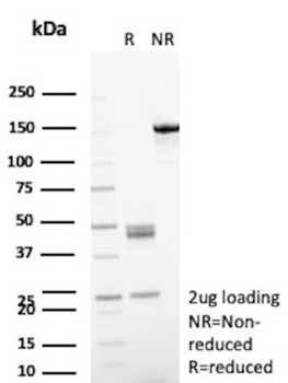 AKR1C1 Antibody