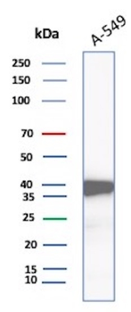 AKR1C1 Antibody