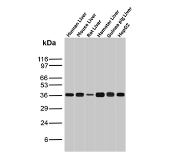 AKR1C1 Antibody