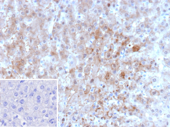 AKR1C1 Antibody