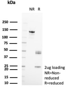 AKR1C1 Antibody