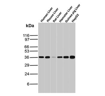 AKR1C1 Antibody