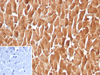 FABP3 Antibody