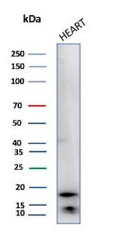 FABP3 Antibody