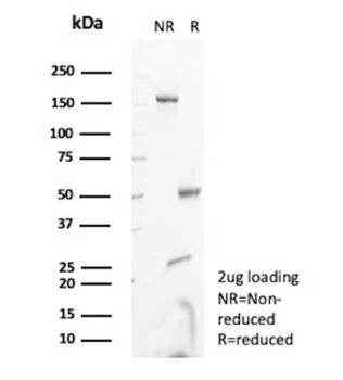 FABP3 Antibody