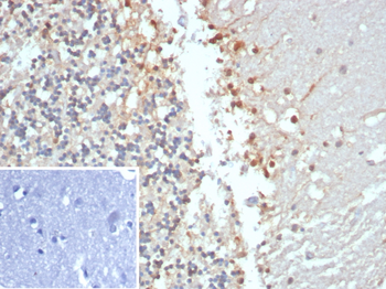CKB Antibody