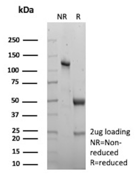 CKB Antibody