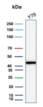 CKB Antibody