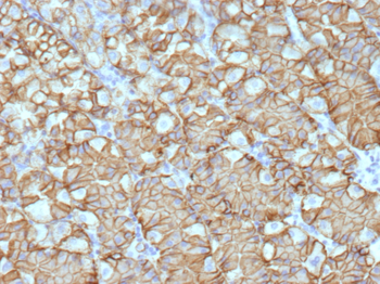 CA9 Antibody