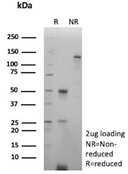 CA9 Antibody