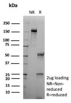 CA9 Antibody