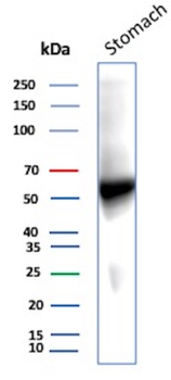 CA9 Antibody