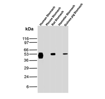 CA9 Antibody