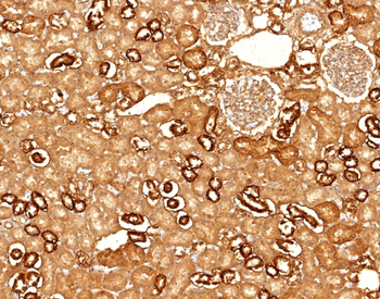 CDH16 Antibody