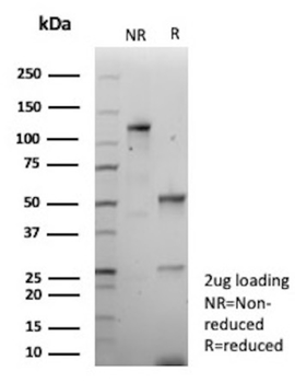 CDH16 Antibody