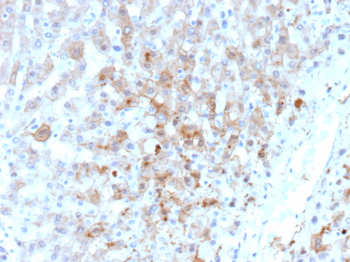 AKR1C1 Antibody