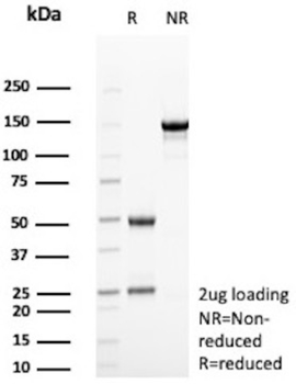 AKR1C1 Antibody