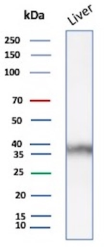 AKR1C1 Antibody