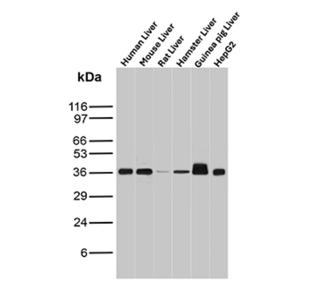 AKR1C1 Antibody