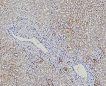 AKR1C1 Antibody