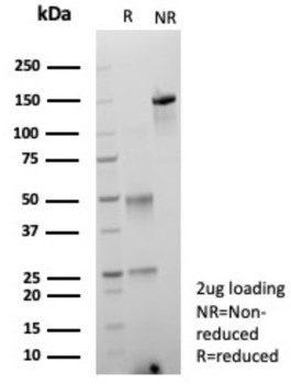 AKR1C1 Antibody