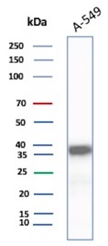 AKR1C1 Antibody