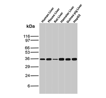AKR1C1 Antibody