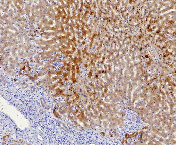 AKR1C1 Antibody