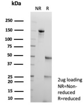 AKR1C1 Antibody