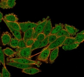 SRF Antibody