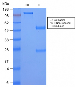 NA, SAA1 Antibody