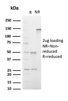 NA, SAA1 Antibody