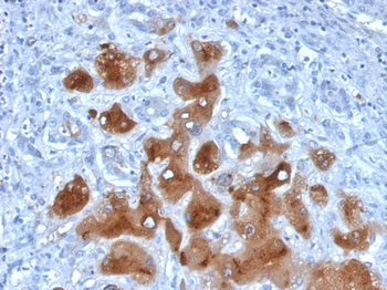 NA, SAA1 Antibody