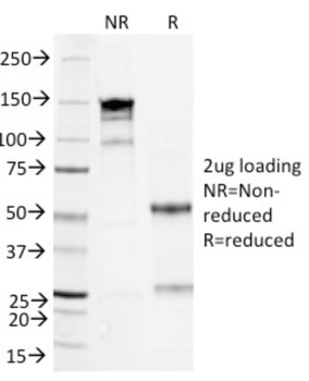 NA, SAA1 Antibody