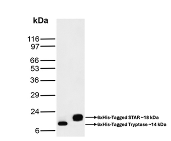 Recombinant Hexa-histidine (Epitope Tag) Antibody