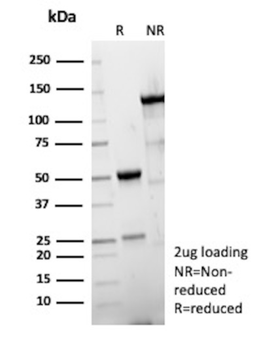 Recombinant Hexa-histidine (Epitope Tag) Antibody