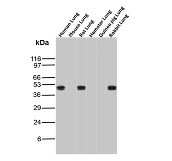 KRT77 Antibody