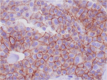 CDH1 Antibody