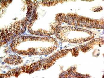 CDH1 Antibody