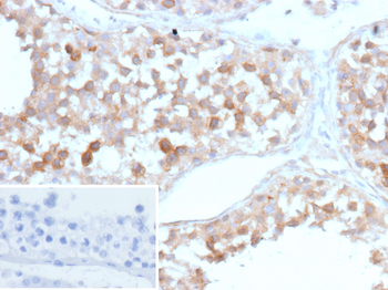 SV2A Antibody