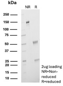 SV2A Antibody