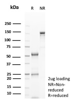 ABCC3 Antibody