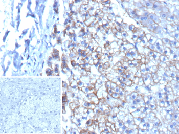 ABCC3 Antibody