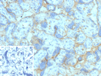 NECTIN4 Antibody