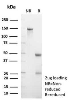 NECTIN4 Antibody