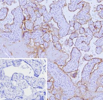 NECTIN4 Antibody