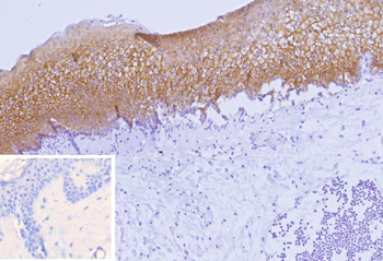 NECTIN4 Antibody