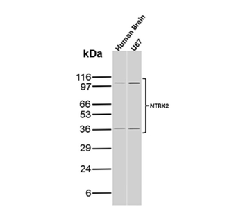 NECTIN4 Antibody