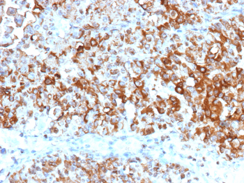 UPK2 Antibody