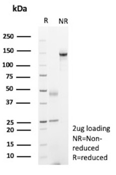 HNF1B Antibody